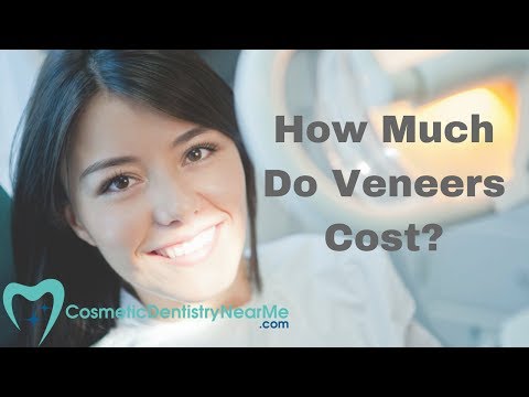 How much do veneers cost? How much do veneers cost?