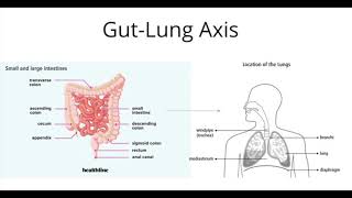 Gut Microbiota and COVID 19_Josie Rossbach