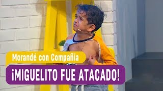 ¡Miguelito fue atacado por un perro! - Morandé con Compañía 2017