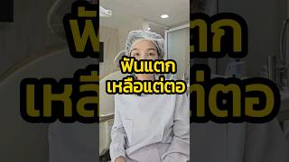 ฟันแตก เหลือแต่ตอทำไงดี #ฟันแตก #ยิ้มพิมพ์ใจ #ฟันปลอม  #ทันตกรรมครบวงจร  #ถอนฟัน #รากเทียม