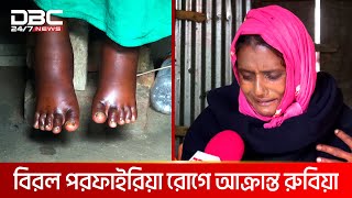 ৩ সন্তানের জন্য বাঁচতে চান রুবিয়া | DBC NEWS Special