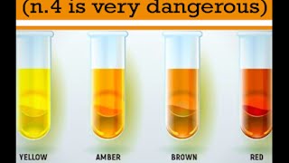 What Your Urine Color Says About Your Health | Urinary System Breakdown