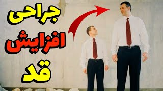 جراحی افزایش قد | انجام بدیم؟