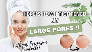 How to Get Rid of Large Pores Naturally