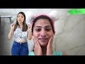 HOW To CURE PimplesAcne - Expectations vs Reality  #Skincare #Routine #Anaysa