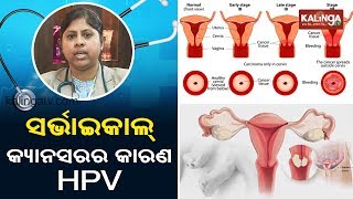 Cervical cancer, HPV(ସର୍ଭାଇକାଲ କ୍ୟାନସର) | Chikitsaka || Kalinga TV