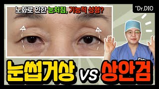 [ENG/성형지식] 노화로 인한 눈처짐을 개선하는 방법! 눈썹거상술🤩 vs 상안검수술😎