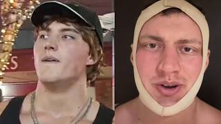 Looksmaxxing Streamer Just Got MUCH Worse
