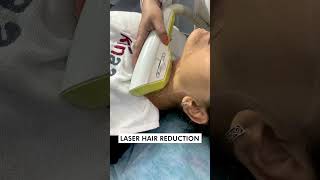 Laser Hair Reduction 101 | Skinaa Clinic #laserhairreduction #viral #ytshorts #shorts