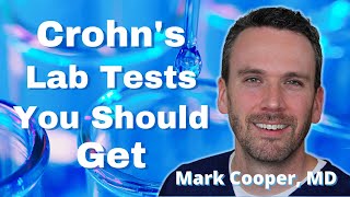 Best Tests to Manage Crohns Disease