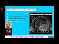 fetal echocardiography registry review