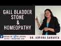 गाल ब्लैडर स्टोन के लक्षण और होमियोपैथी इलाज || GALL BLADDER Stone & Homeopathy