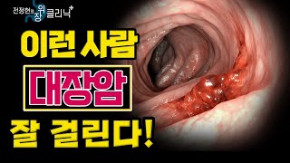 대장암 전조 증상! 이 용종은 대장암의 씨앗입니다 - 전정현의 위장 클리닉 #10ㅣ대장용종 대장내시경 선종성용종