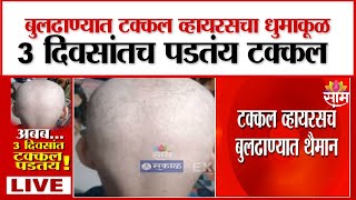 New virus in Buldhana; Bald within 3 days : बापरे! बुलढाण्यात नवा व्हायरस; ३ दिवसांतच पडतं टक्कल?