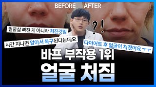 바디프로필 부작용! 급격한 다이어트 후 늙어보인다? 망가진 피부 응급 처치 방법을 알려드립니다.