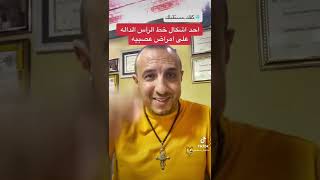 احد اشكال خط الرأس الداله على امراض عصبيه