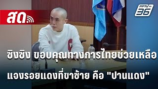 🔴 Live โชว์ข่าวเช้านี้ | ซิงซิง ขอบคุณทางการไทยช่วยเหลือ แจงรอยแดงที่ขาซ้าย คือ \