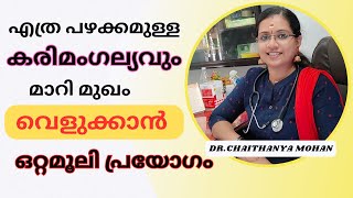 കരിമംഗല്യം മാറി മുഖം വെളുത്ത് സുന്ദരമാകും🤩എത്ര പഴക്കം ചെന്ന കറുത്ത പാടുകളും മാറും🔥#melasma #beauty