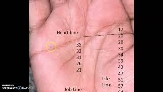 Palmistry Timing 24: Issues at 31, Marriage troubles