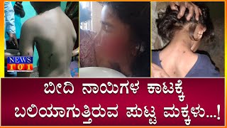 Street Dog Attacks on Children |  5 ಮಕ್ಕಳ ಮೇಲೆ ದಾಳಿ ಮಾಡಿದ ಬೀದಿ ನಾಯಿ