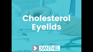 Cholesterol Eyelids - Help \u0026 Advice Guide About Cholesterol Eyelids - Brought To You By XANTHEL®