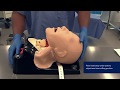 The LMA® Gastro™ Airway Instructional Video