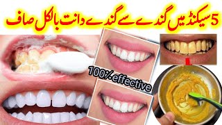 Teeth whitening At Home| Dant Saf krny ka tarika