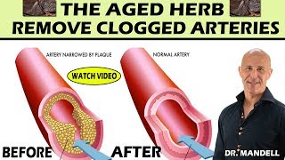 THE AGED HERB...REMOVE CLOGGED ARTERIES, LOWER CHOLESTEROL & BLOOD PRESSURE - Dr Alan Mandell, DC