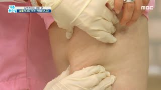 [기분 좋은 날] 집에서 쉽고 빠르게 셀룰라이트 진단하는 방법!, MBC 210421 방송