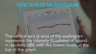 Understanding your audiogram