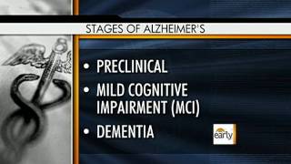New Alzheimer's guidelines