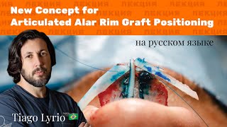 Лекция: New Concept for Articulated Alar Rim Graft Positioning (на русском языке)