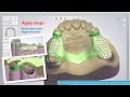 3 Shape Dental System Removable Partial Framework Design And SLM Production