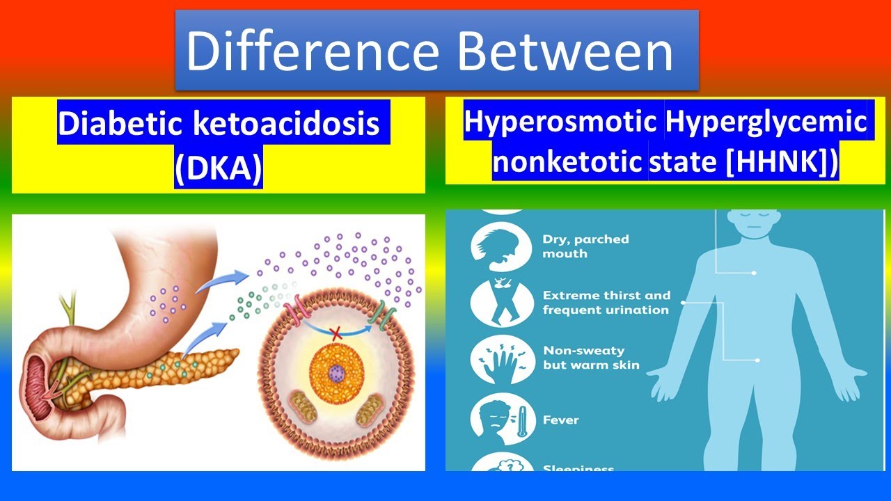 Diabetic Ketoacidosis (DKA) Vs. Hyperosmotic Hyperglycemic Nonketotic ...