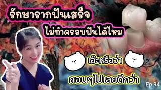 🎬Ep.94 รักษารากฟันเสร็จ ไม่ทำครอบฟันได้ไหมหมอ /จะรักษารากหรือถอนฟันดี  @หมอฟันลงจอ