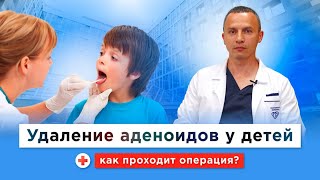 Надо ли удалять детям аденоиды? Как удаляют аденоиды бесплатно по ОМС в Морозовской больнице