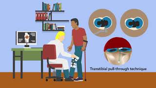 Repair of medial meniscus root tear could prevent progression to arthritis and knee arthroplasty