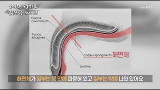 [굴곡형 임플란트의 특성] 충분한 이해를 통해 내린 결정은 좀 더 만족도가 높은 결과를 기대할 수 있습니다_(세움비뇨기과 박성훈원장) 팽창형임플란트/세조각보형물/발기부전수술