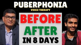 Unbelievable Voice Transformation: Before-After Puberphonia Therapy in Just 8 Days | #SLPSanjayKumar