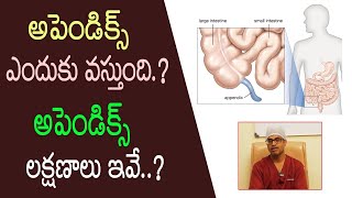 అపెండిక్స్ రావడానికి అసలు కారణాలు| Appendix Symptoms In Telugu | Doctors Health Tips | V Health