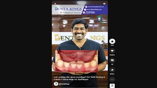 பால் பல்லிற்கு பின் பற்கள் வளர்கிறதா? Are Teeth Growing in 2 Rows ? | Denta Kings | Dr. Karthikeyan