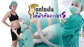 รีวิวดูดไขมันหน้าท้อง เอว S น้องแพท ::: [Siam Loft Clinic]