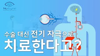 전기 자극으로 상처 신경 회복시키는 전자약 개발한 기업 │뉴아인 (2019)