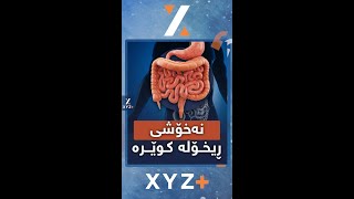 نەخۆشی ڕیخۆڵە کوێرە چییە و نیشانەکانی چین؟