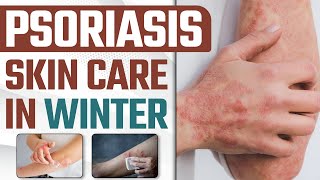 Psoriasis Skin Care In winter | सर्दियों में सोरायसिस से कैसे बचे ? | Dr Health