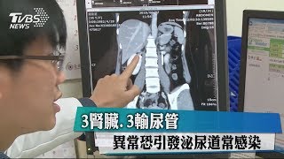 3腎臟、3輸尿管　異常恐引發泌尿道常感染