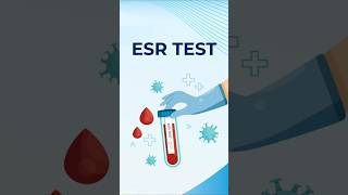 Erythrocyte Sedimentation Rate | ESR Test