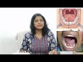 काली जीभ कैंसर तो नहीं जीभ के नीचे काला होने का कारण और इलाज tongue cancer black tongue