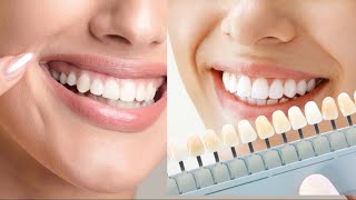 How to get Healthy White Teeth