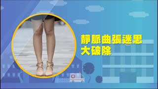 靜脈曲張迷思大破除（#張學倫醫師）#醫師來解答